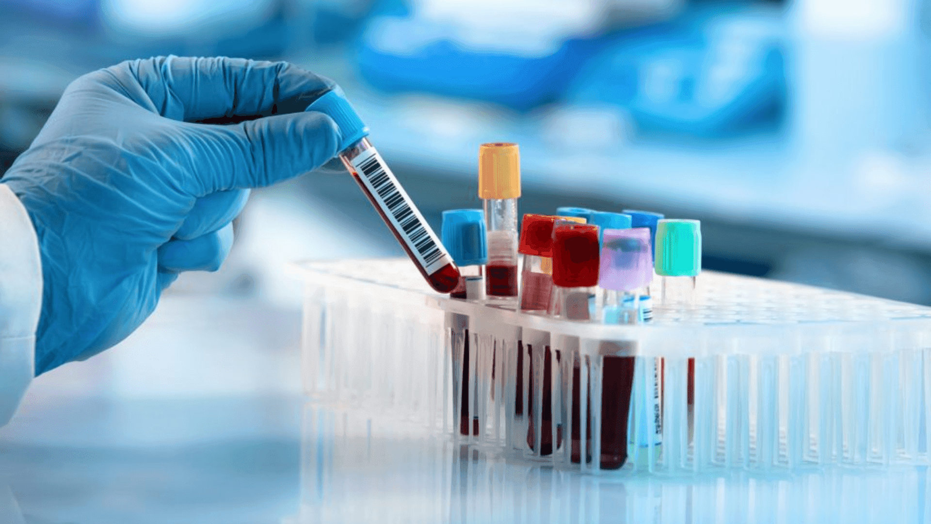 Mano con guanto azzurro che preleva una provetta di sangue da un rack in laboratorio