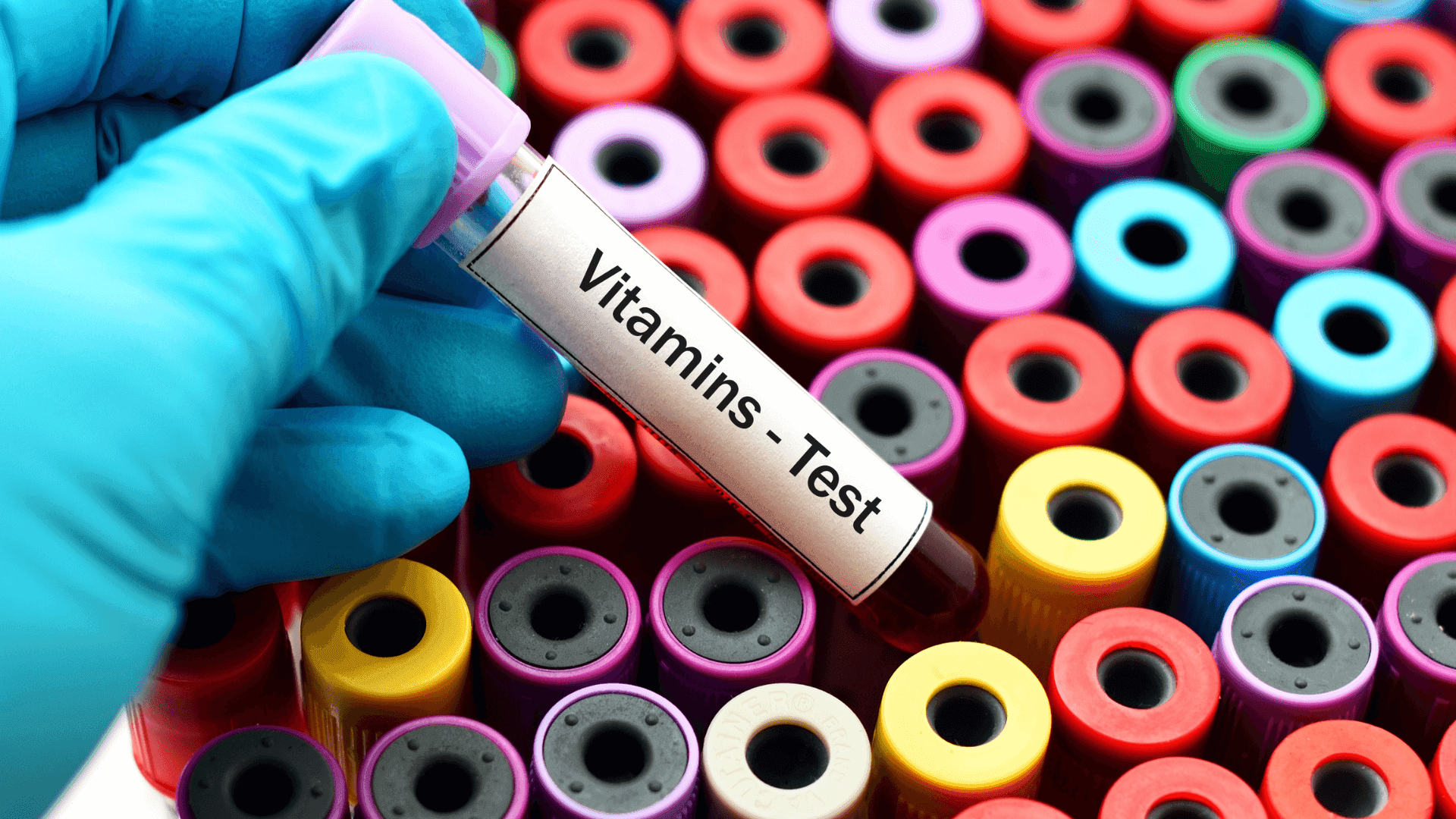 Mano con guanto azzurro che tiene una provetta con l’etichetta «Vitamins - Test» sopra un rack di provette dai tappi colorati